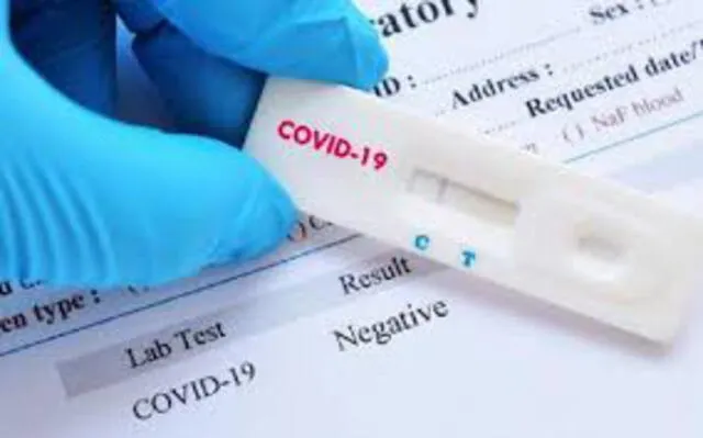 Los tests rápido permitirán diagnosticar más rápido a las personas con COVID-19. (Foto: Innova Spain)