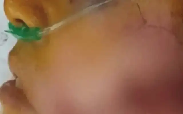 La mujer resultó con graves heridas.