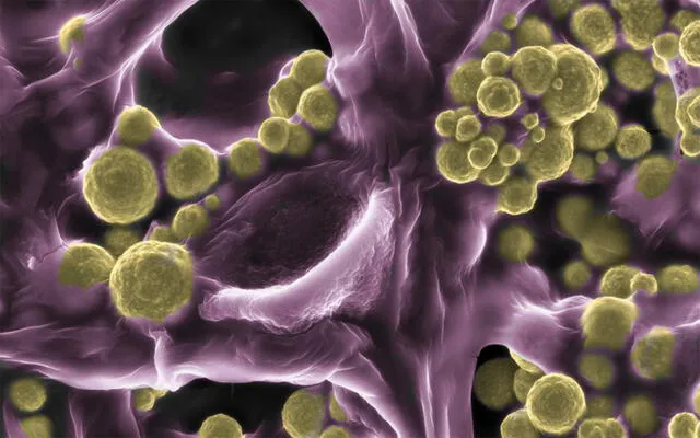 El hongo australiano Fusarium oxysporum puede encontrar oro para adherirlas con ellas. Foto: CSIRO El hongo australiano Fusarium oxysporum puede encontrar oro para adherirlas con ellas. Foto: CSIRO
