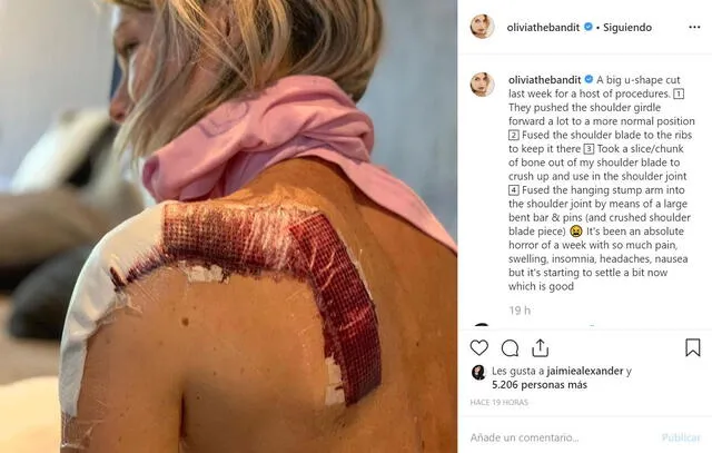 Olivia Jackson, doble de Milla Jovovich, perdió el brazo