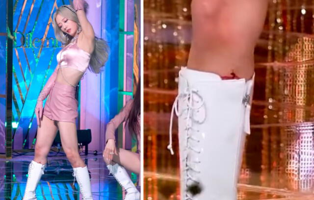 Bomi: la herida fue visible en la fancam publicada por SBS. Foto: capturas/YouTube SBS