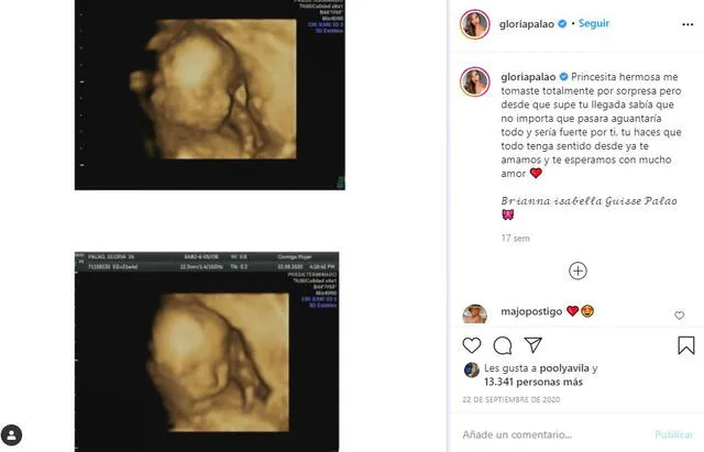 Gloria Palao anuncia su embarazo
