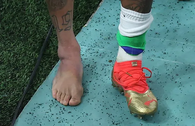 Así quedó el tobillo derecho de Neymar tras el duelo ante Serbia. Foto: AFP