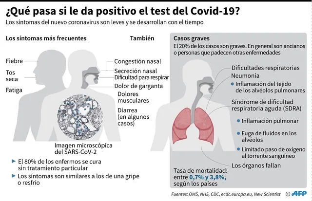 Los síntomas de la COVID-19 por AFP. Foto: AFP.