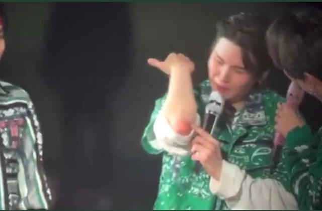 Suga mostró el raspón en su brazo tras resbalarse en el concierto. Foto: captura/Twitter