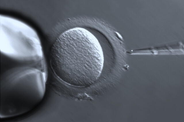La hazaña fue posible tras crear un óvulo a partir de células madre masculinas. Foto: ZEISS Microscopy/Flickr   