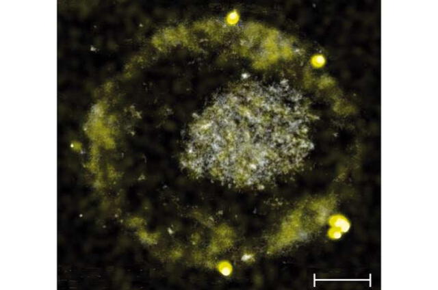 La bacteria expulsa pepitas de oro tras procesar metales tóxicos en su interior. Foto: Sociedad Estadounidense de Microbiología   