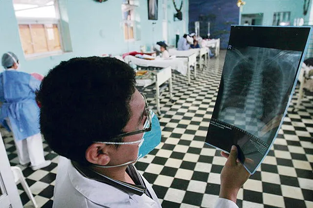 En 12 regiones del Perú existe riesgo alto de tuberculosis