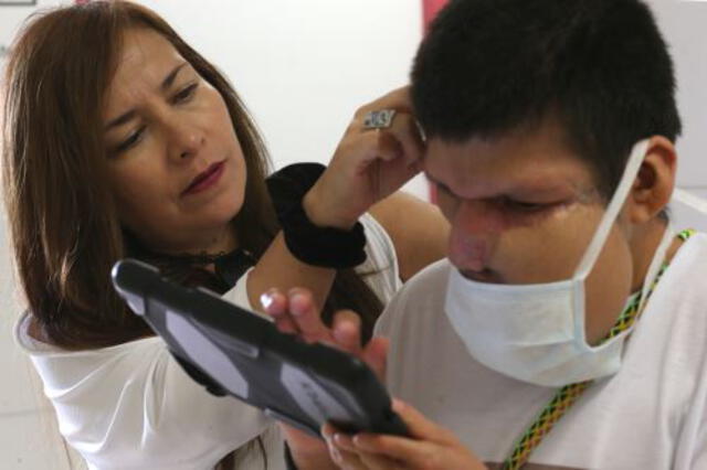 Reconstruyen rostro de paciente con tumor en Hospital de Emergencia de Villa El Salvador