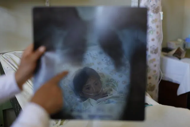  Aumentaron y registran casos agudos de neumonía en el norte del país. Foto: difusión   