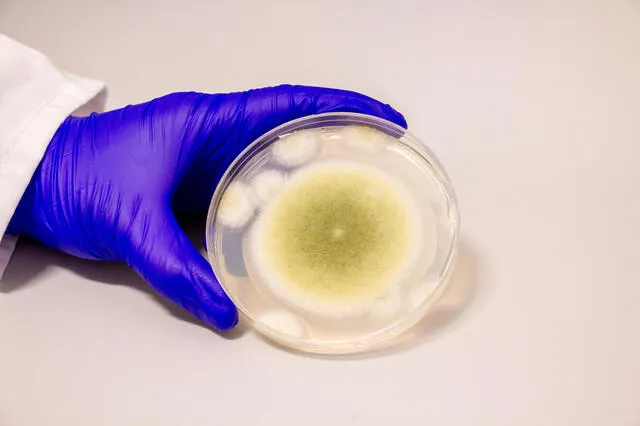 Una muestra de Aspergillus flavus cultivada en el Laboratorio Gao. Foto: Bella Ciervo Una muestra de Aspergillus flavus cultivada en el Laboratorio Gao. Foto: Bella Ciervo