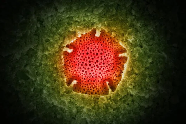 Granos de polen encontrados analizados con microscopía. Foto: Michael Freese.