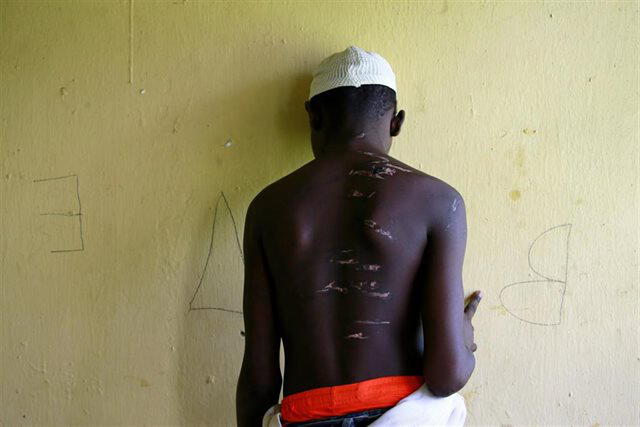 Los jóvenes llevan cicatrices en su cuerpo por las torturas. Foto: BBC