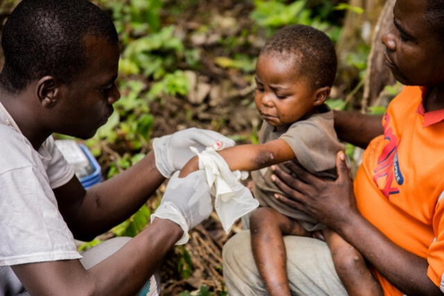 La mayoría de personas contagiadas por el clado 1b de mpox son menores de 15 años. Foto: AFP   