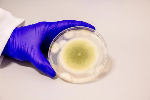 Una muestra de Aspergillus flavus cultivada en el Laboratorio Gao. Foto: Bella Ciervo Una muestra de Aspergillus flavus cultivada en el Laboratorio Gao. Foto: Bella Ciervo