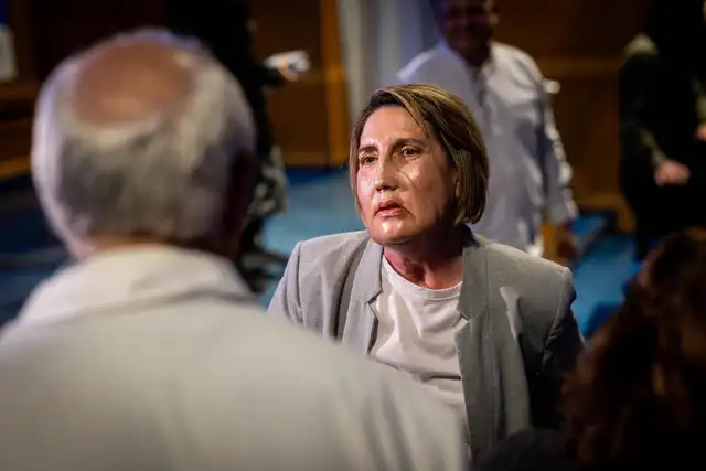 Los especialistas prepararon modelos de la donante y la receptora con antelación. Foto: Hospital Universitario Vall d'Hebron/Jordi Otix<br> Los especialistas prepararon modelos de la donante y la receptora con antelación. Foto: Hospital Universitario Vall d'Hebron/Jordi Otix<br>