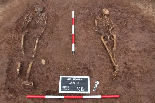 Restos oseos encontrados durante la excavación.