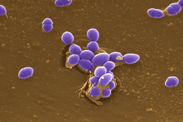 Enterococcus faecalis es la bacteria que podría generar daños en la salud. Foto: Centro para el Control y la Prevención de Enfermedades, Instituto Nacional de Salud   