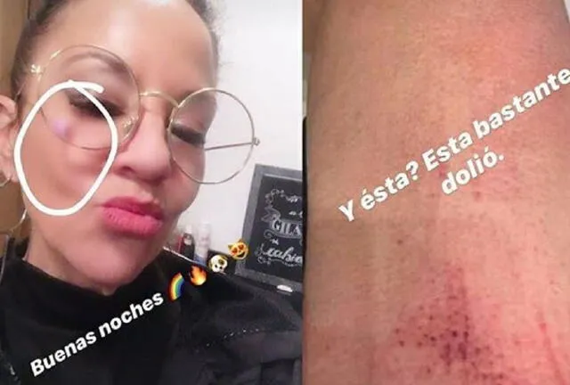 Miss Bolivia mostró los golpes que recibió. (Foto: Internet)