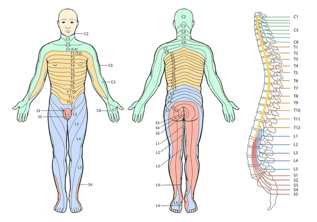  Las heridas del herpes zóster suelen aparecer en una o más franjas del cuerpo que son inervadas por el nervio espinal. Foto: Medspine   