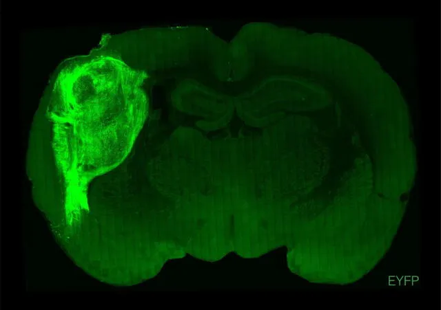 Un organoide cerebral humano resalta en color fluorescente en el cerebro de una rata. Foto: Standford