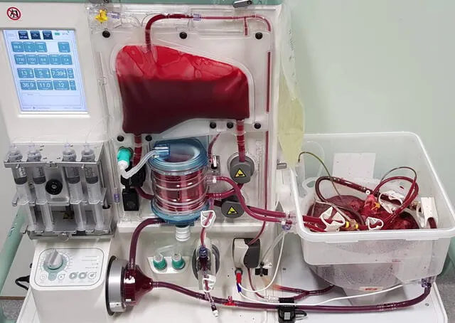 Un hígado donado en la máquina de perfusión normotérmica 'OrganOx'. DAVID NASRALLA ET AL / El País