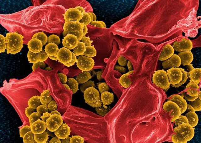  La bacteria SARM, en amarillo, escapa de un glóbulo blanco (rojo), puede avanzar sin control y, en última instancia, acabar con nuestro organismo. Foto: NIAID   