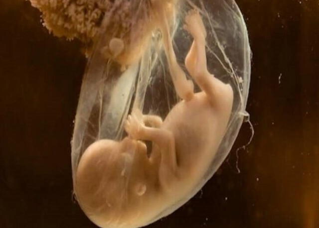 Los úteros artificiales aún no son bien vistos por la comunidad científica. Foto: Primicia