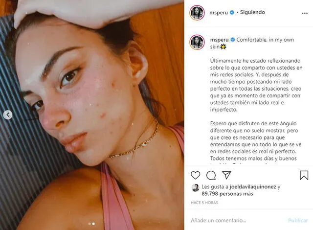 Natalie Vértiz muestra sus imperfecciones en Instagram