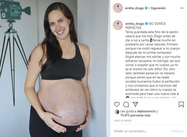 Emilia Drago muestra sus estrías en Instagram