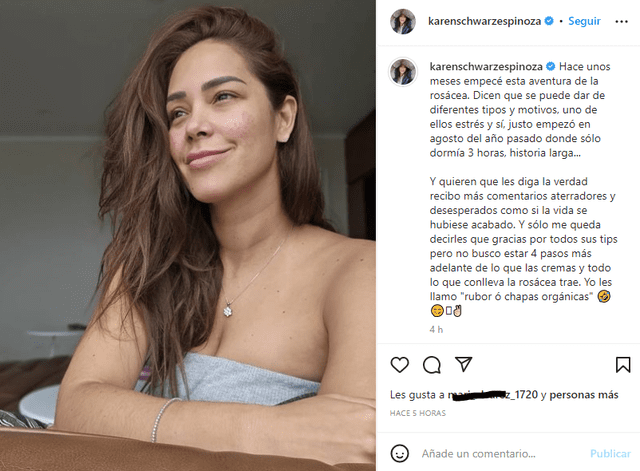 "Yo les llamo rubor o chapas orgánicas", indicó Karen Schwarz tras revelar que tiene rosácea. Foto: captura de Instagram/Karen Schwarz    