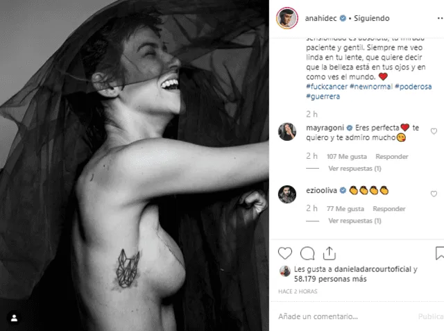 Anahí de Cárdenas muestra la cicatriz de su mastectomía en Instagram