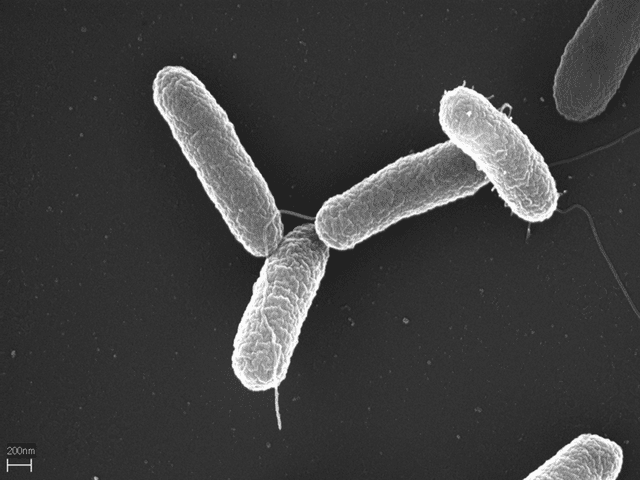 La Salmonella typhimurium causa diarreas, dolores abdominales, vómitos y náuseas. Imagen microscópica. Foto: Volker Brinkmann / Max Planck Institute for Infection Biology