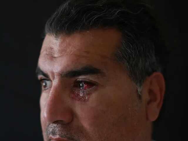 Albano Toro (40), paramédico, herido mientras atendía pacientes. Fotografía: Luis Sergio
