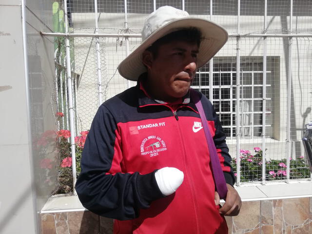  A José Silva Miranda le mutilaron parte de la mano derecha. Foto: Kleber Sánchez/La República    