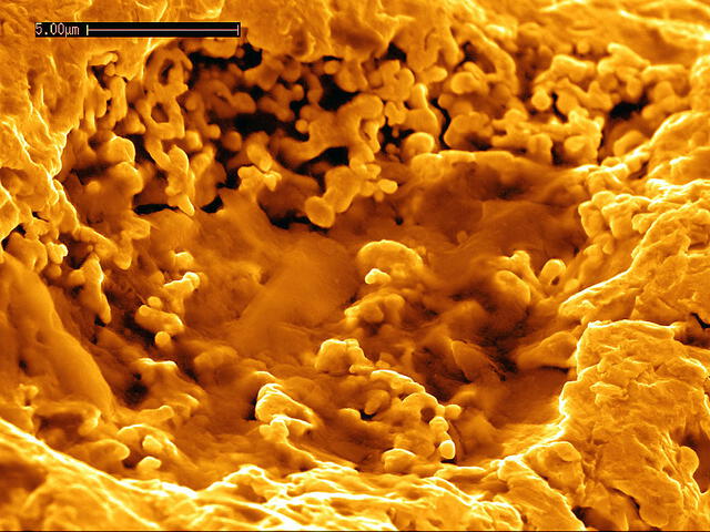  Las bacterias juegan un papel importante en la formación de pepitas de oro en Australia. Foto: CSIRO    