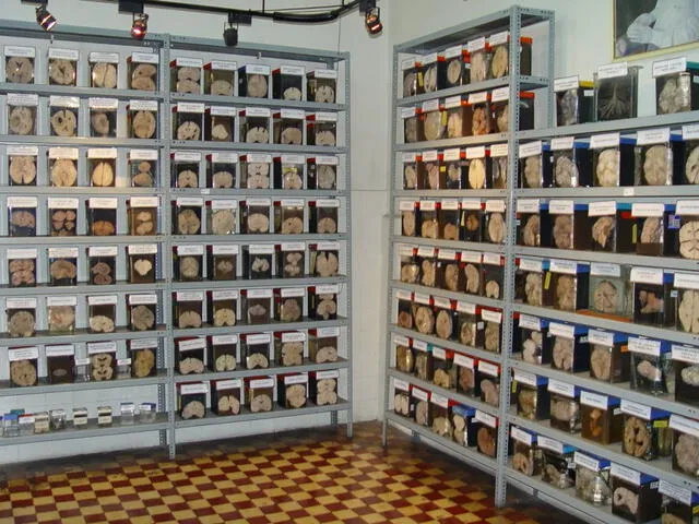  En este museo se encuentran diferentes tipos de cerebros. Foto: Instituto Nacional de Ciencias Neurológicas   