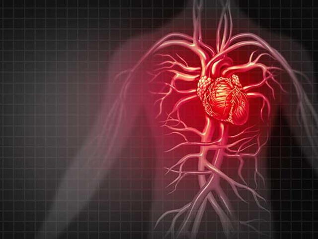 La miocarditis es una inflamación del músculo cardíaco (miocardio). Es decir, el corazón se inflama, lo que puede debilitarlo y dificultar que bombee sangre de manera eficiente al resto del cuerpo. Foto: National Cancer Institute La miocarditis es una inflamación del músculo cardíaco (miocardio). Es decir, el corazón se inflama, lo que puede debilitarlo y dificultar que bombee sangre de manera eficiente al resto del cuerpo. Foto: National Cancer Institute
