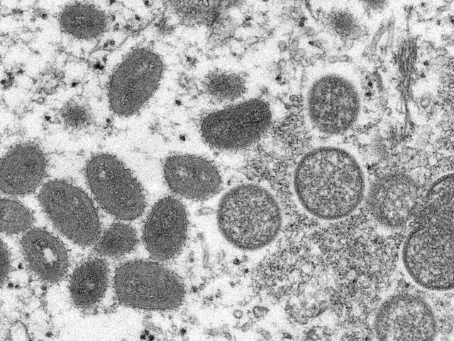 La nueva variante del virus es aparentemente más letal. Foto: AFP   