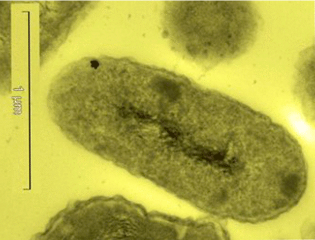  Cupriavidus metallidurans es una bacteria de morfología de bacilo. Foto: ESRF   