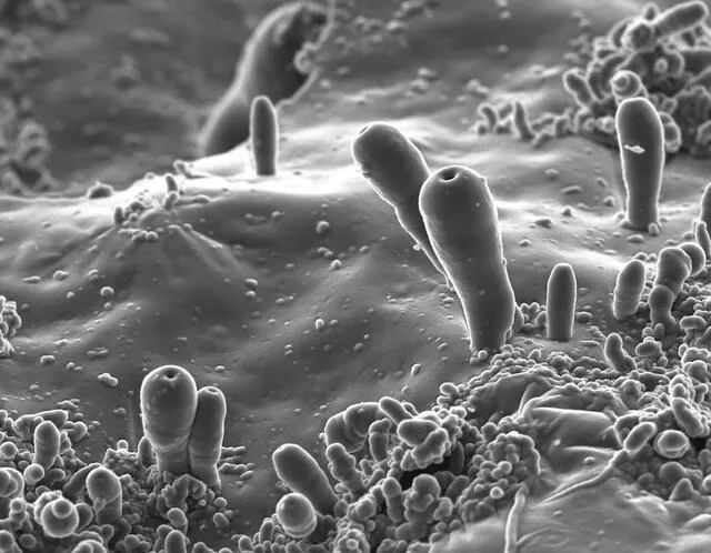  Las "protocélulas" a través de un microscopio que fueron observadas en el experimento del equipo de Juan Manuel García Ruiz.   