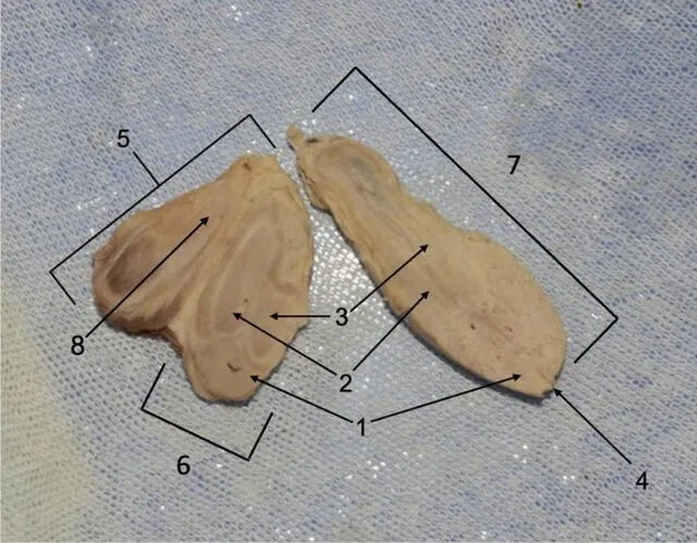 Disección ex situ de la trifalia. Esta figura muestra una sección de la línea media de la triplicación peneana. Se han identificado las siguientes estructuras 1. cuerpos esponjosos del glande (con uretra), 2. cuerpos esponjosos de los penes primario y secundario, 3. cuerpos cavernosos de los penes primario y secundario, 4. meato uretral externo del pene primario, 5. pene terciario, 6. pene secundario, 7. pene primario y 8. cuerpos cavernosos del pene terciario. Foto: artículo científico/Buchanan et al.   