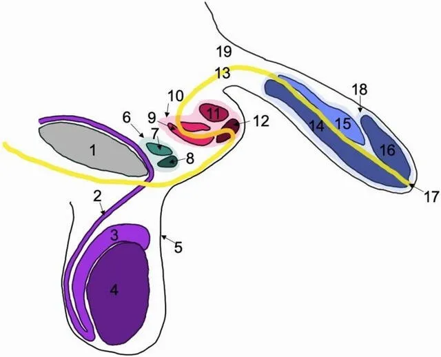 Diagrama esquemático de la trifalia interna. Esta figura es un diagrama esquemático de la sección transversal sagital de la pelvis masculina en este caso. La disposición de los trifalios puede verse arriba. El diagrama puede etiquetarse como sigue: 1. sínfisis púbica, 2. conducto deferente, 3. epidídimo, 4. testículo, 5. piel, 6. pene terciario, 7. cuerpo cavernoso del pene terciario, 8. glande del pene terciario, 9. cuerpo esponjoso del pene secundario, 10. pene secundario, 11. cuerpo cavernoso del pene secundario, 12. glande del pene secundario, 13. conducto uretral, 14. cuerpo esponjoso del pene primario (continuo con el glande), 15. conducto uretral del pene primario (continuo con el glande). glande del pene secundario, 13. conducto uretral, 14. cuerpo esponjoso del pene primario (continuo con el glande), 15. cuerpo cavernoso del pene primario, 16. glande del pene primario, 17. orificio uretral, 18. pene primario, y 19. tejido conjuntivo. Foto: artículo científico/Buchanan et al.