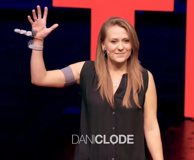 La creadora del Third Thumb, Danielle Clode, en una charla de TedTalk. Foto: Captura de YouTube