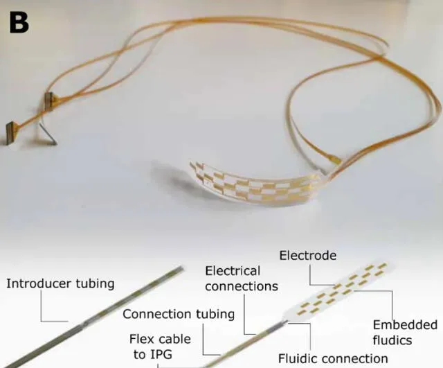 El dispositivo completo (arriba), mostrado en forma enrollada y desenrollada (abajo). Foto: Woodington et al., Sci. Adv., 2021