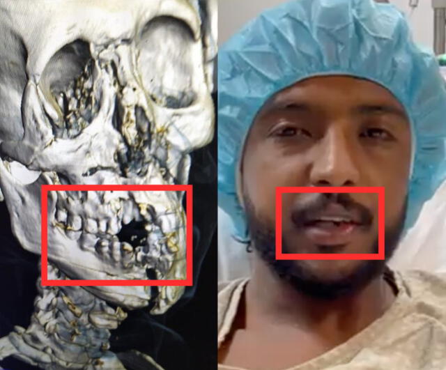 Comparación entre la supuesta imagen de rayos X y el video publicado por la Selección de Arabia Saudita. Foto: composición Verificador