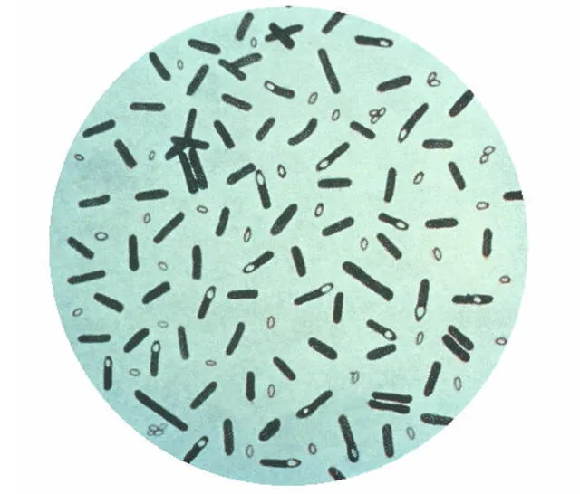 Microfotografía de la bacteria Clostridium botulinum. Foto: CDC