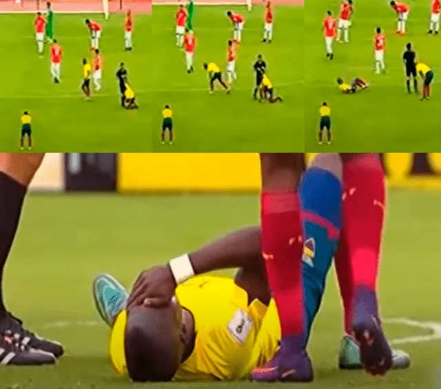 Imágenes de la "lesión" de Enner Valencia, jugador de Ecuador.