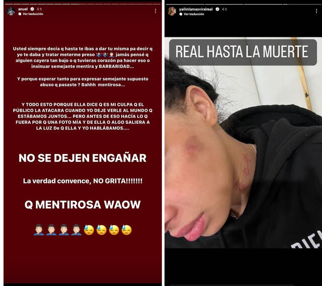  Anuel rechaza acusación de Yailin. Ella presenta prueba de agresión. Foto: captura Instagram<br><br>    