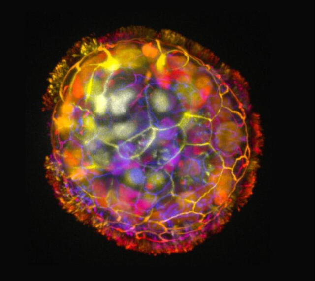  Un antropobot coloreado, con sus cilios alrededor. Foto: Universidad de Tufts   